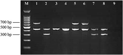 Prevalence, Virulence Genes and Antimicrobial Resistance Profiles of Salmonella Serovars from Retail Beef in Selangor, Malaysia